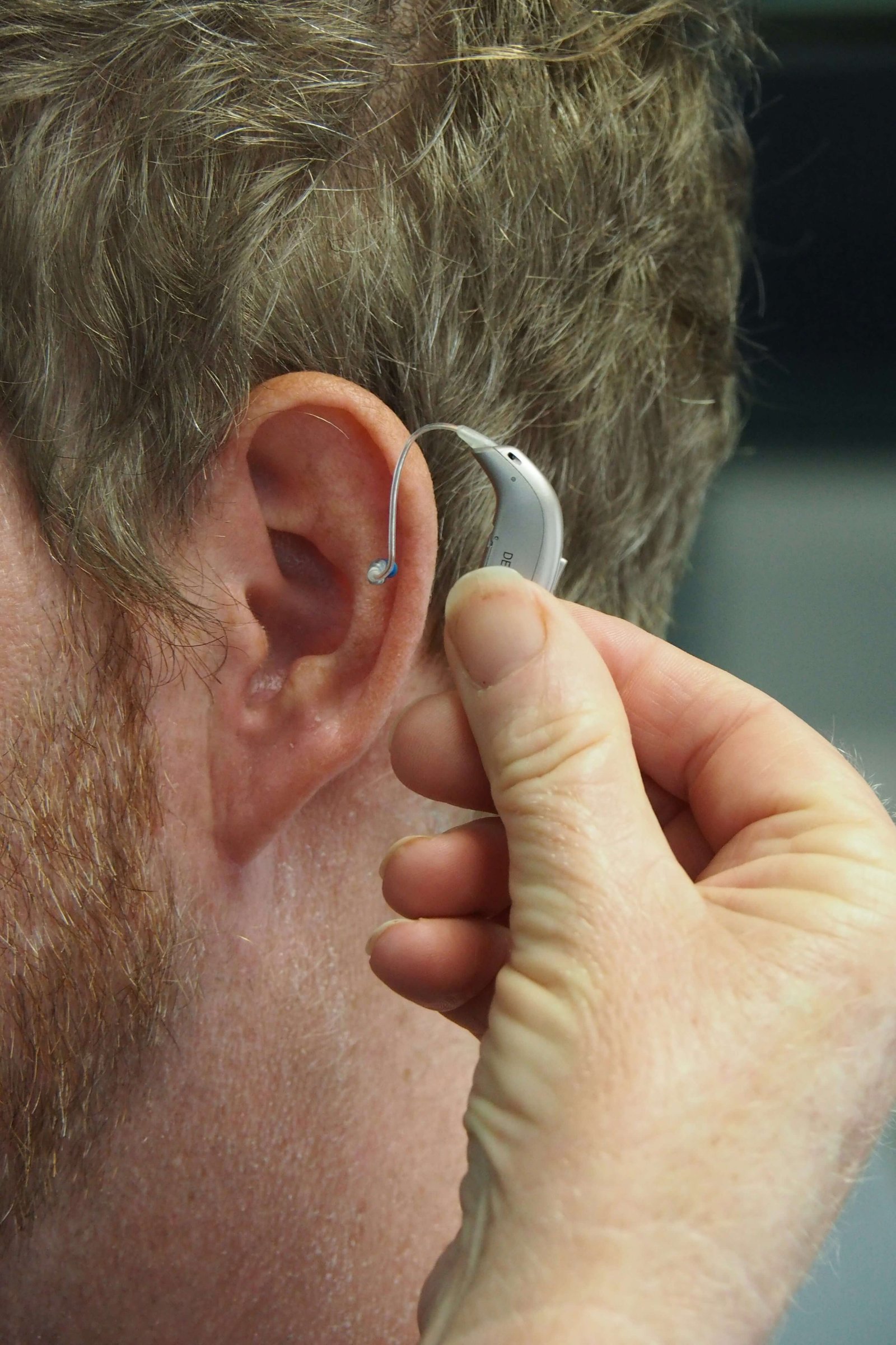 Cochlear Implant Mapping